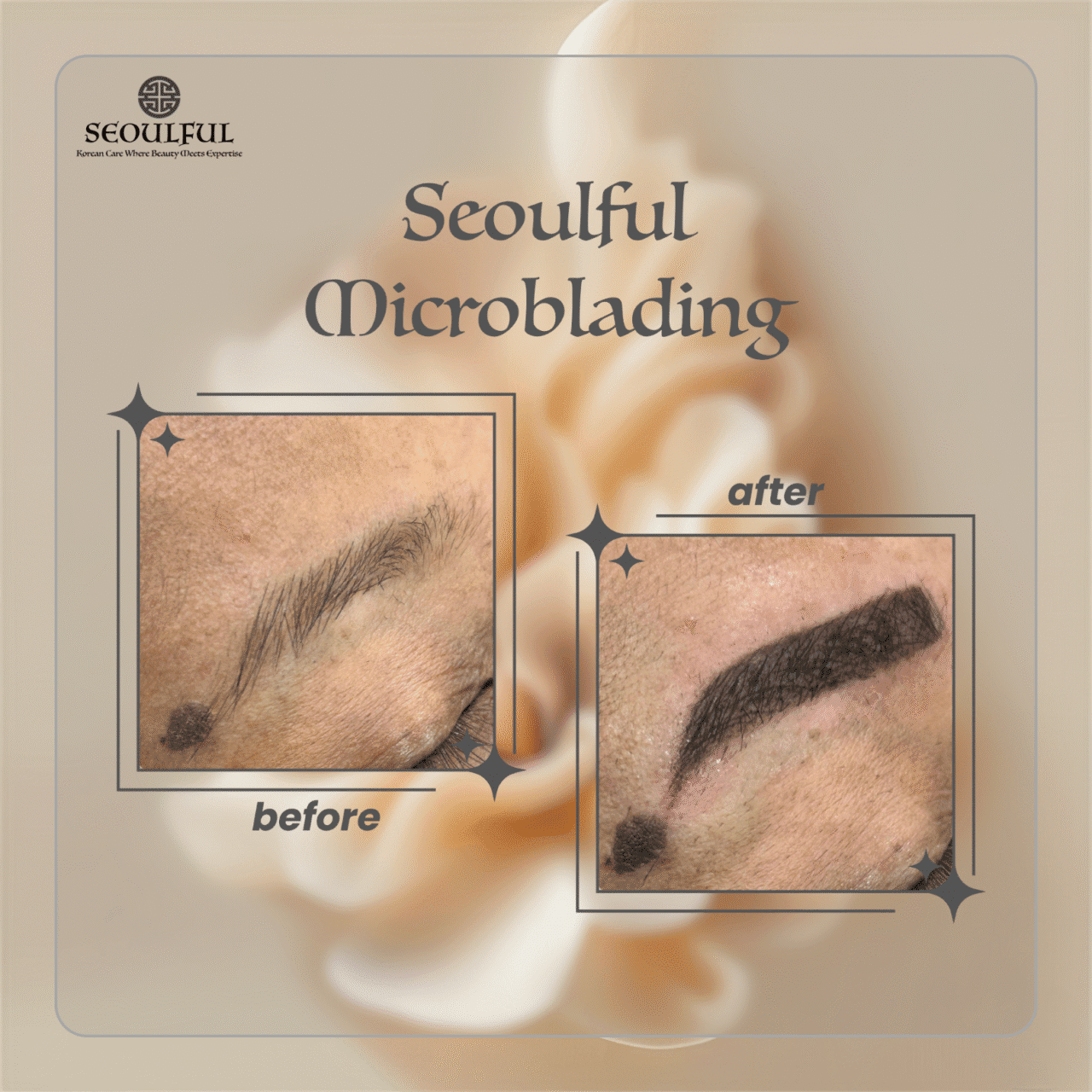 Microblading