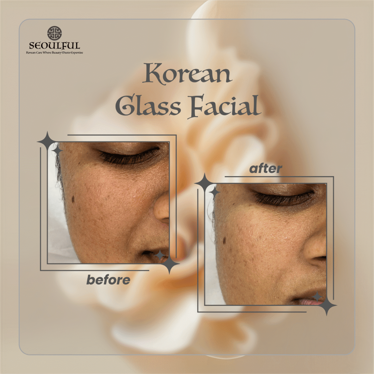 Glass Facial