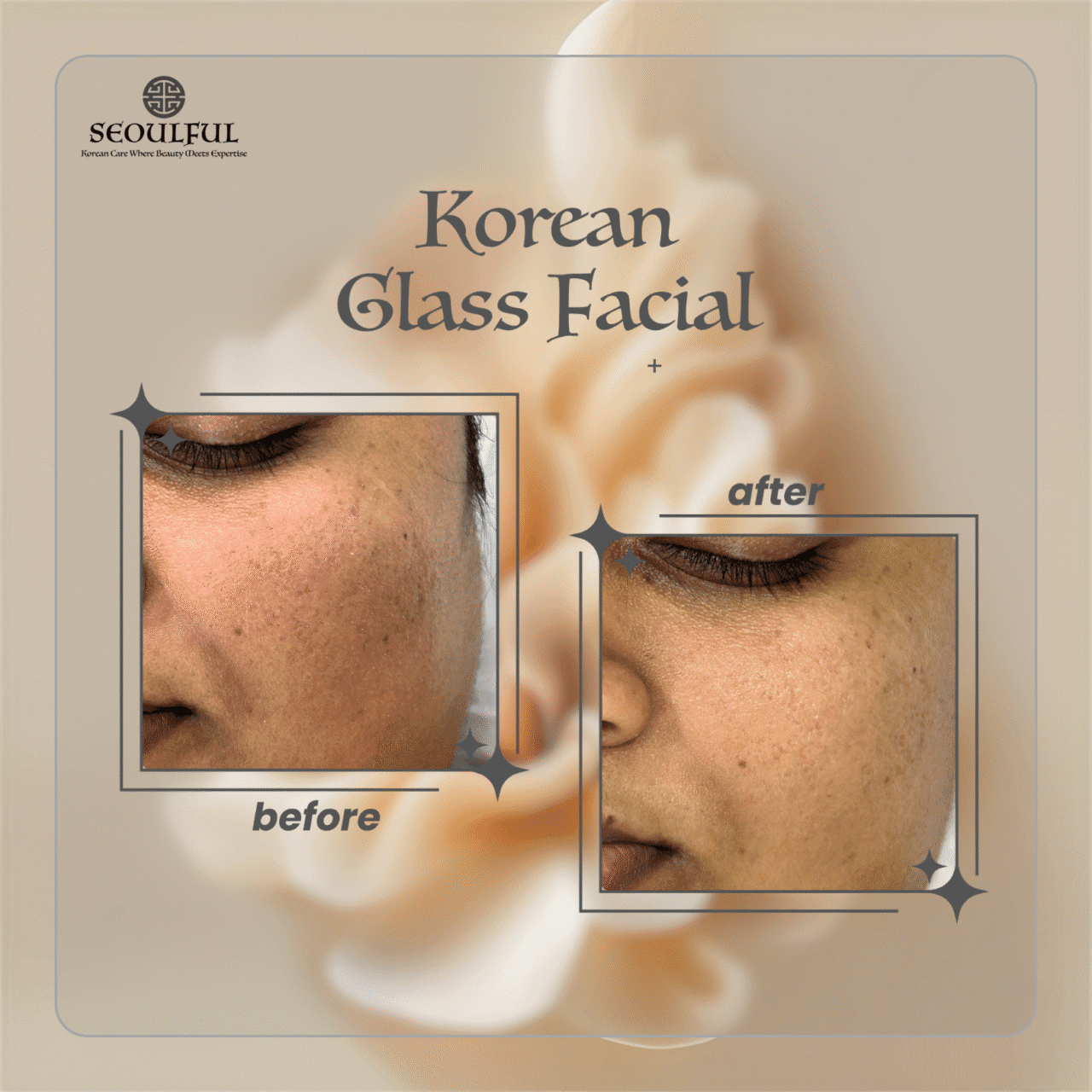 Glass Facial