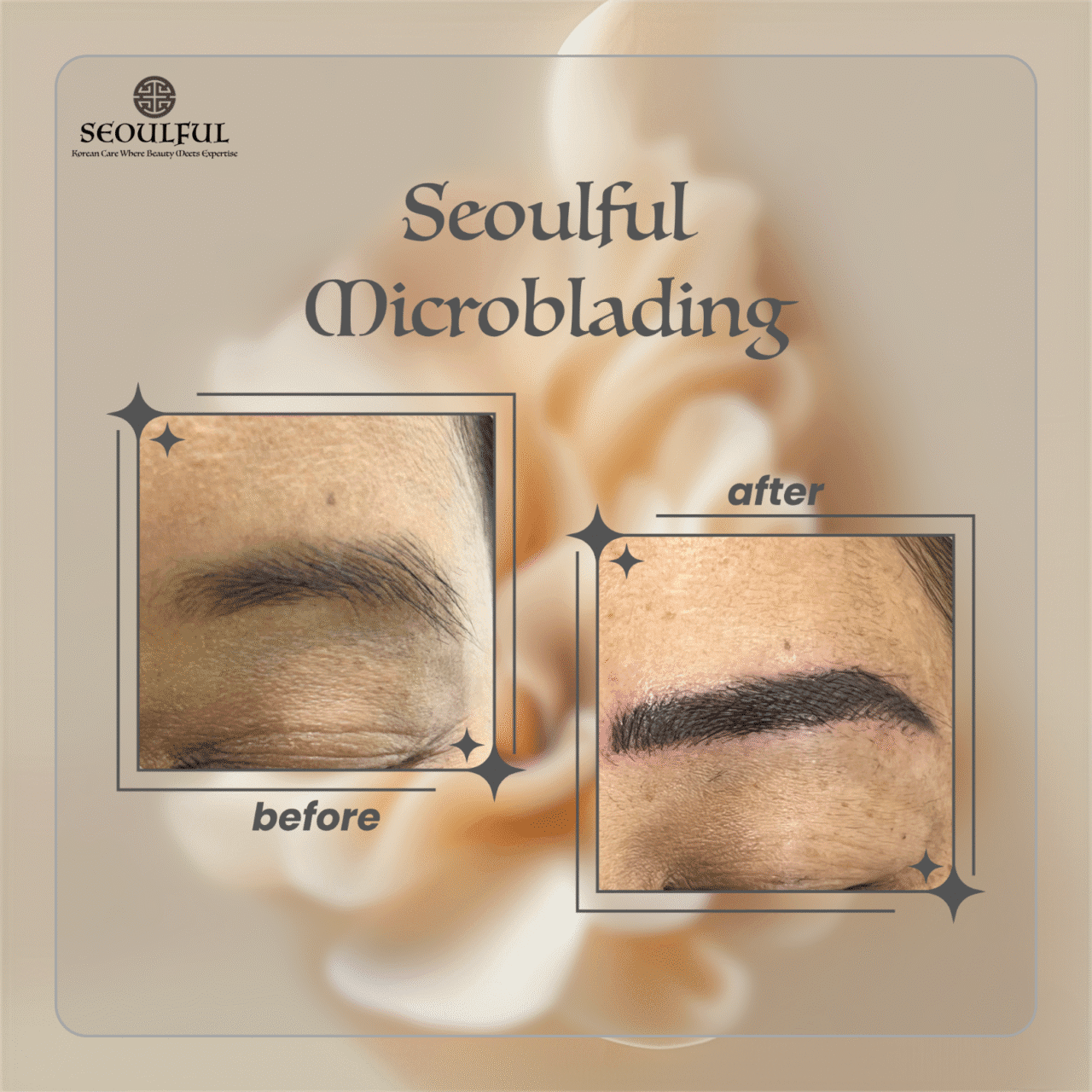 Microblading